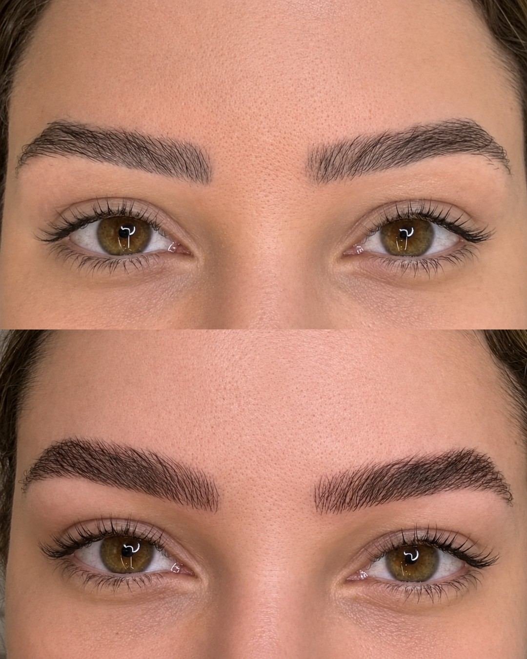 Antes e depois de remoção a laser e reconstrução de sobrancelha